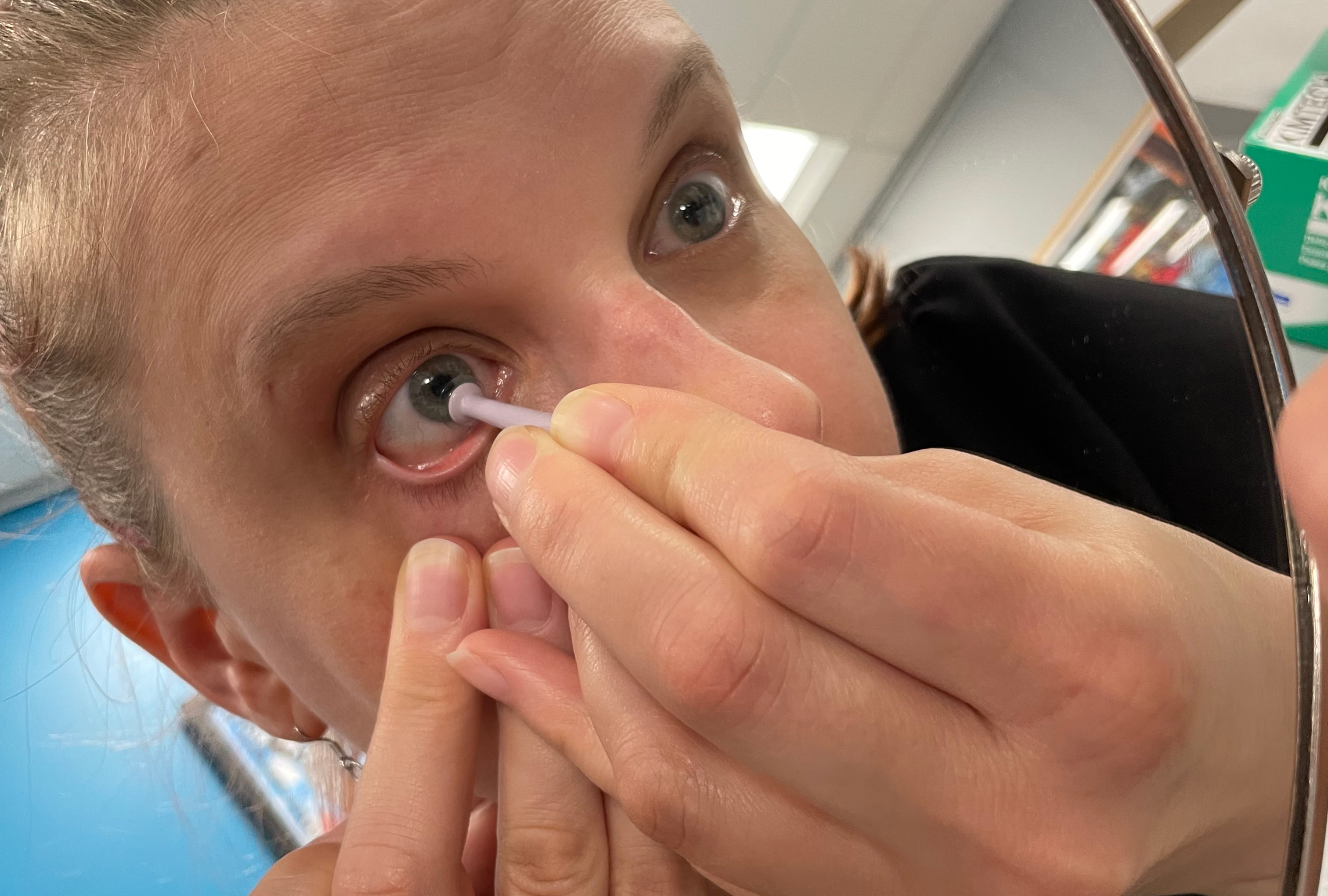 Application and Removal of Ortho-K Lenses