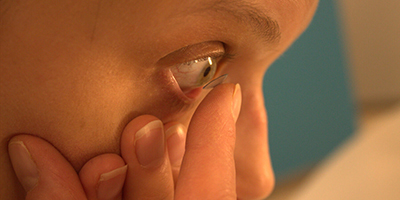 Getting Started with Ortho-K